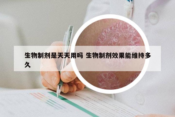 生物制剂是天天用吗 生物制剂效果能维持多久