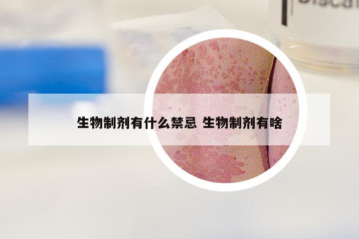 生物制剂有什么禁忌 生物制剂有啥