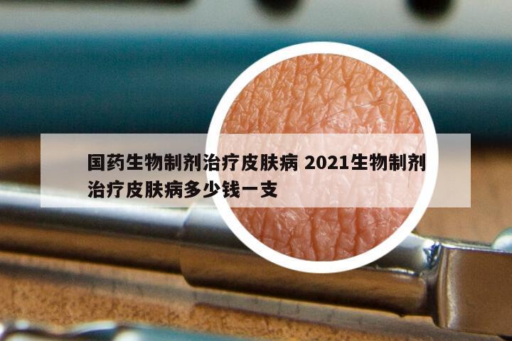 国药生物制剂治疗皮肤病 2021生物制剂治疗皮肤病多少钱一支