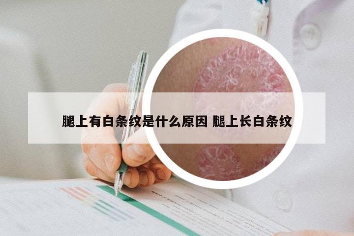 腿上有白条纹是什么原因 腿上长白条纹