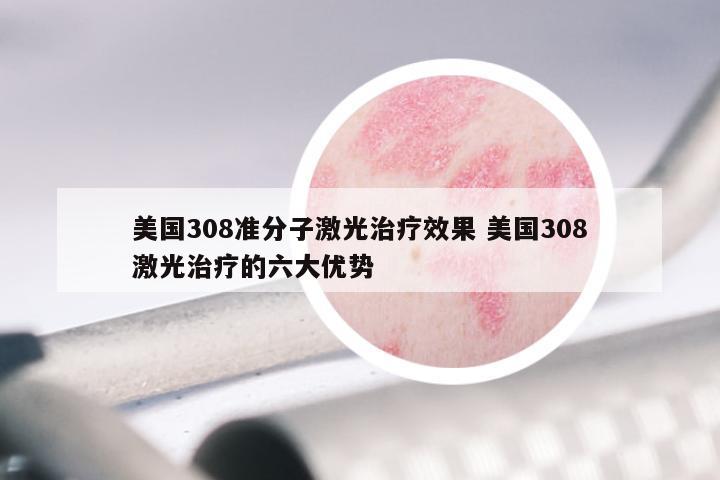 美国308准分子激光治疗效果 美国308激光治疗的六大优势