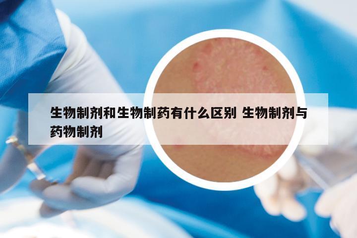 生物制剂和生物制药有什么区别 生物制剂与药物制剂