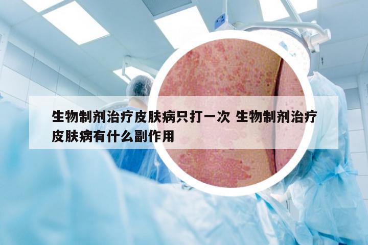 生物制剂治疗皮肤病只打一次 生物制剂治疗皮肤病有什么副作用