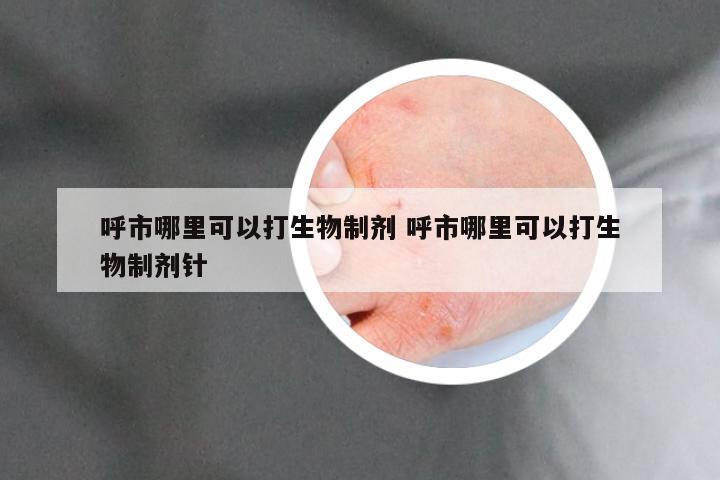 呼市哪里可以打生物制剂 呼市哪里可以打生物制剂针