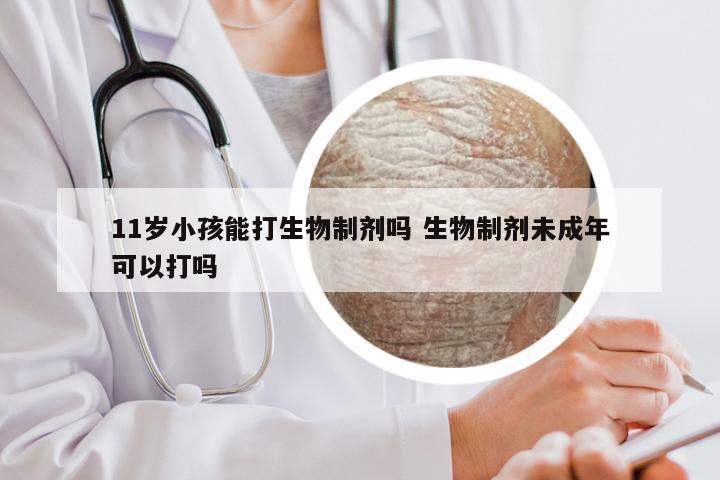 11岁小孩能打生物制剂吗 生物制剂未成年可以打吗