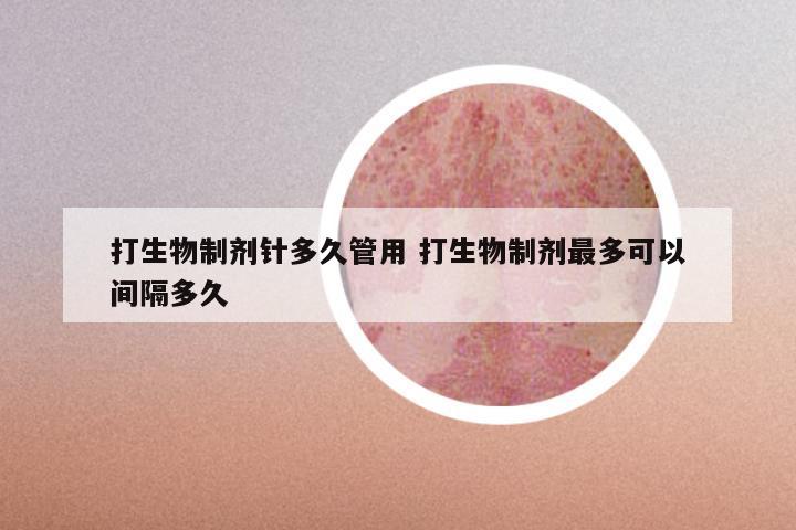 打生物制剂针多久管用 打生物制剂最多可以间隔多久