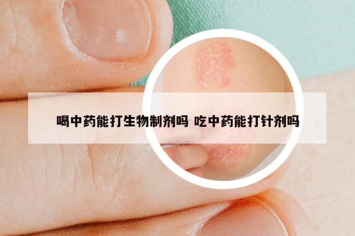 喝中药能打生物制剂吗 吃中药能打针剂吗