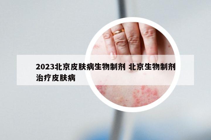 2023北京皮肤病生物制剂 北京生物制剂治疗皮肤病