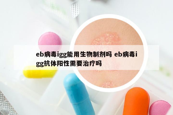 eb病毒igg能用生物制剂吗 eb病毒igg抗体阳性需要治疗吗