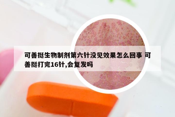 可善挺生物制剂第六针没见效果怎么回事 可善挺打完16针,会复发吗