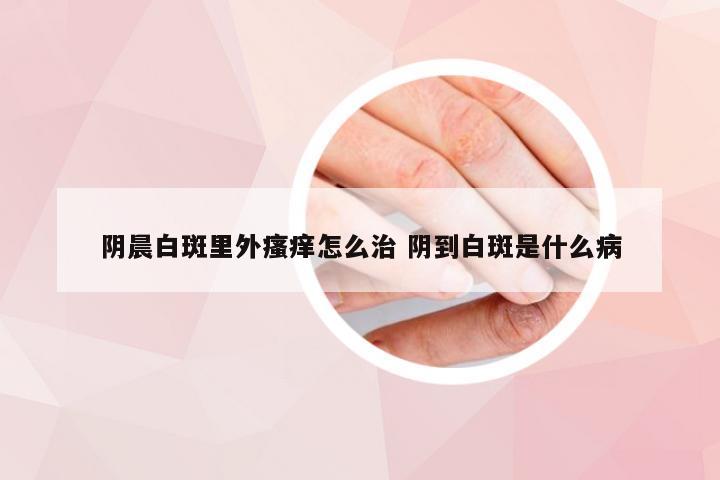 阴晨白斑里外瘙痒怎么治 阴到白斑是什么病