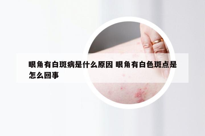 眼角有白斑病是什么原因 眼角有白色斑点是怎么回事