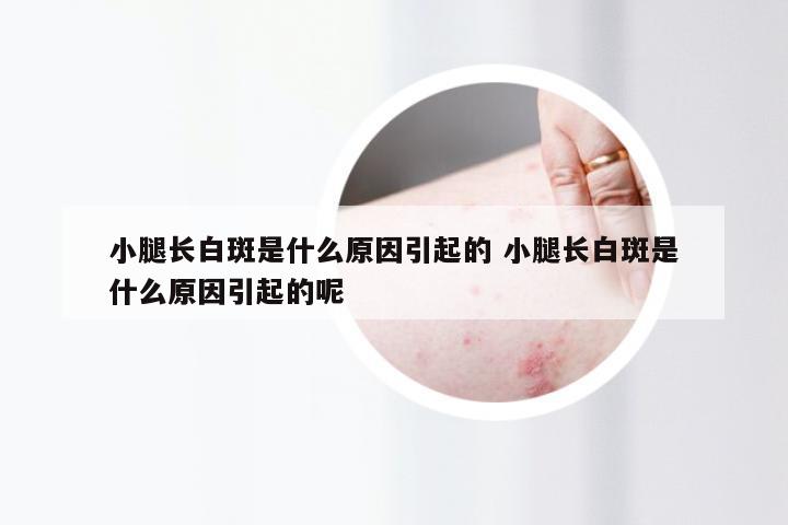 小腿长白斑是什么原因引起的 小腿长白斑是什么原因引起的呢