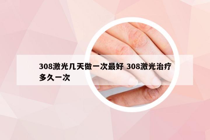 308激光几天做一次最好 308激光治疗多久一次