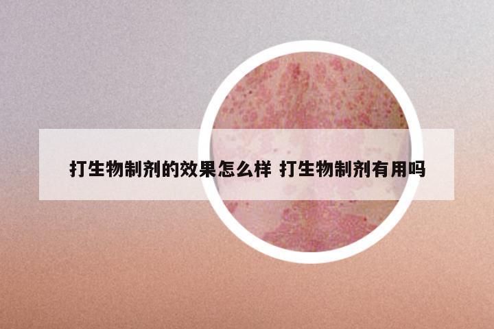 打生物制剂的效果怎么样 打生物制剂有用吗