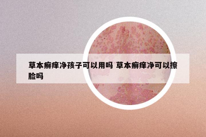 草本癣痒净孩子可以用吗 草本癣痒净可以擦脸吗