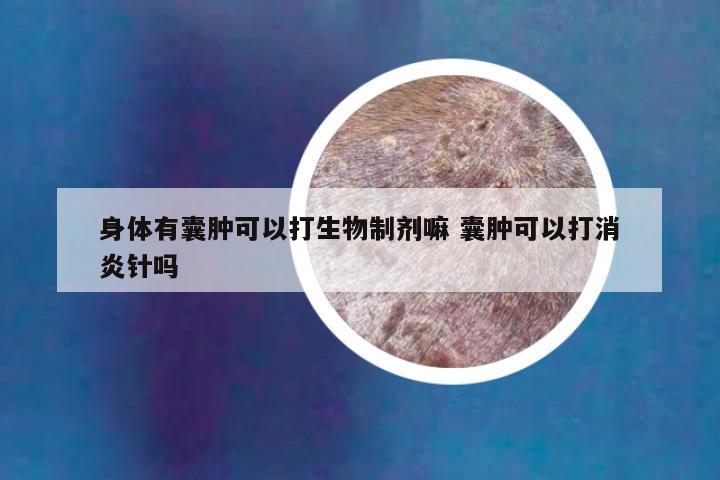 身体有囊肿可以打生物制剂嘛 囊肿可以打消炎针吗