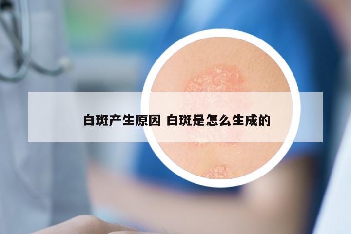 白斑产生原因 白斑是怎么生成的