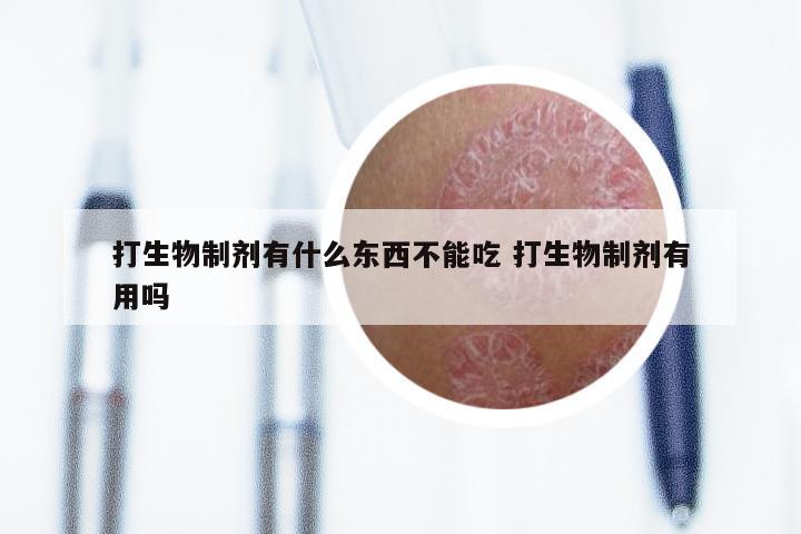 打生物制剂有什么东西不能吃 打生物制剂有用吗