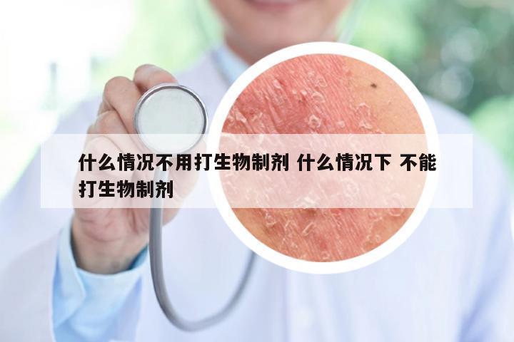 什么情况不用打生物制剂 什么情况下 不能打生物制剂