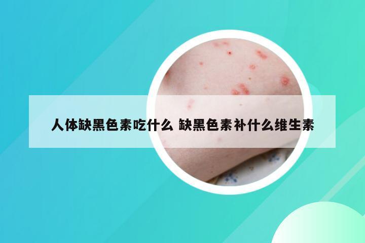 人体缺黑色素吃什么 缺黑色素补什么维生素