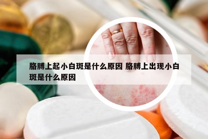 胳膊上起小白斑是什么原因 胳膊上出现小白斑是什么原因