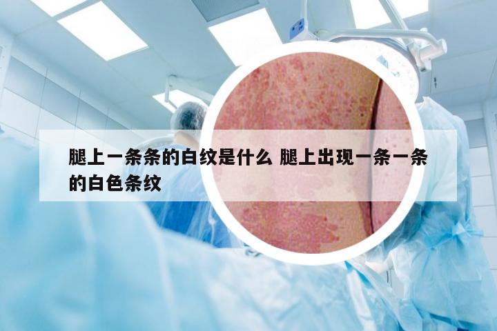 腿上一条条的白纹是什么 腿上出现一条一条的白色条纹