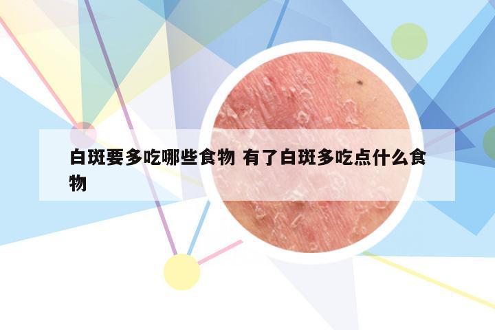 白斑要多吃哪些食物 有了白斑多吃点什么食物