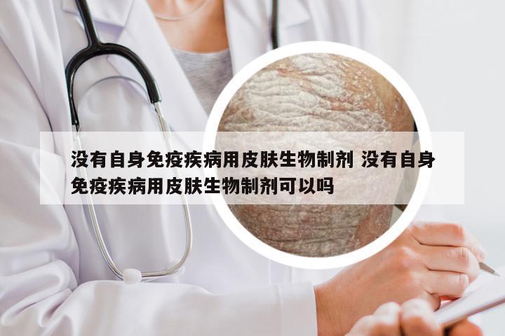 没有自身免疫疾病用皮肤生物制剂 没有自身免疫疾病用皮肤生物制剂可以吗