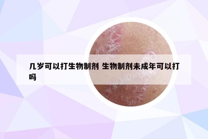 几岁可以打生物制剂 生物制剂未成年可以打吗