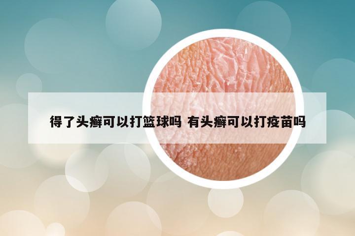 得了头癣可以打篮球吗 有头癣可以打疫苗吗