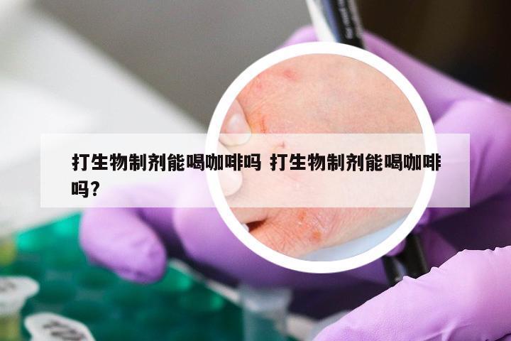 打生物制剂能喝咖啡吗 打生物制剂能喝咖啡吗?