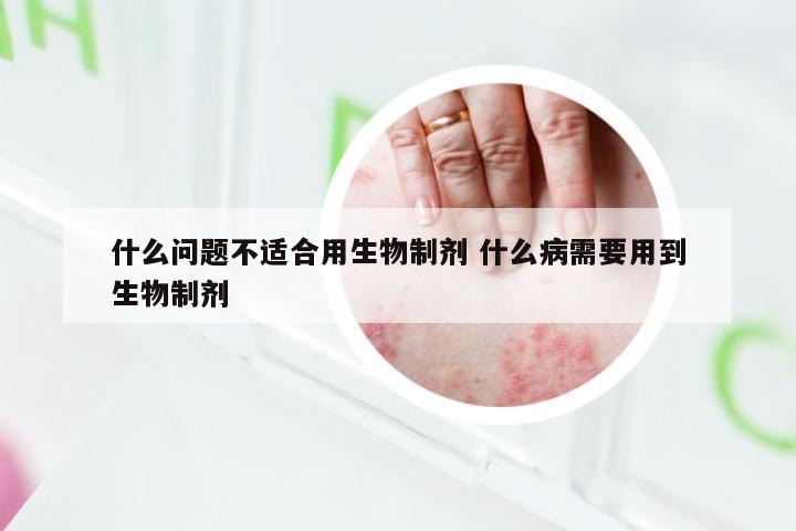 什么问题不适合用生物制剂 什么病需要用到生物制剂