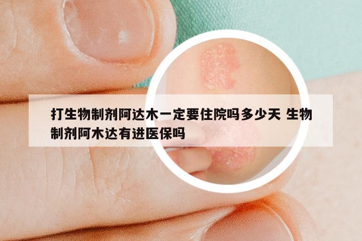 打生物制剂阿达木一定要住院吗多少天 生物制剂阿木达有进医保吗