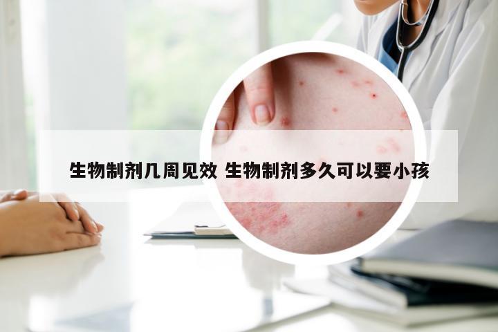 生物制剂几周见效 生物制剂多久可以要小孩