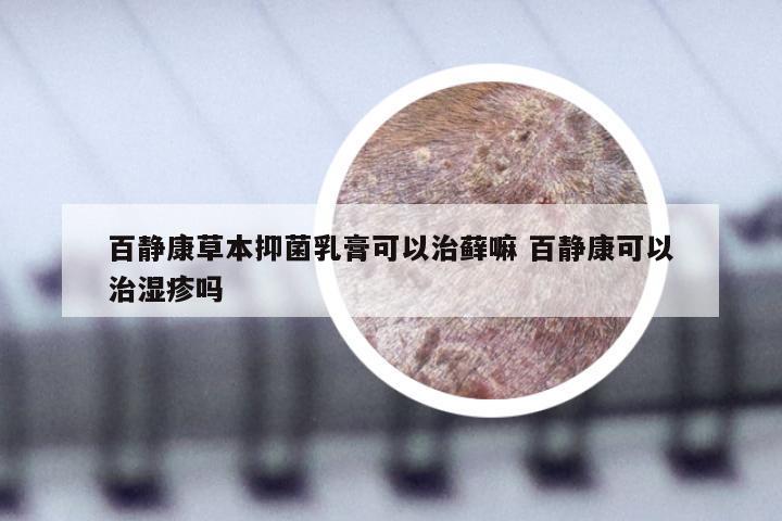 百静康草本抑菌乳膏可以治藓嘛 百静康可以治湿疹吗