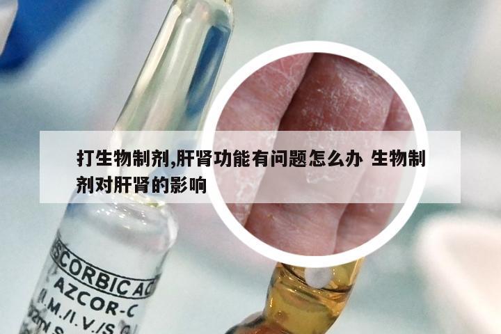 打生物制剂,肝肾功能有问题怎么办 生物制剂对肝肾的影响