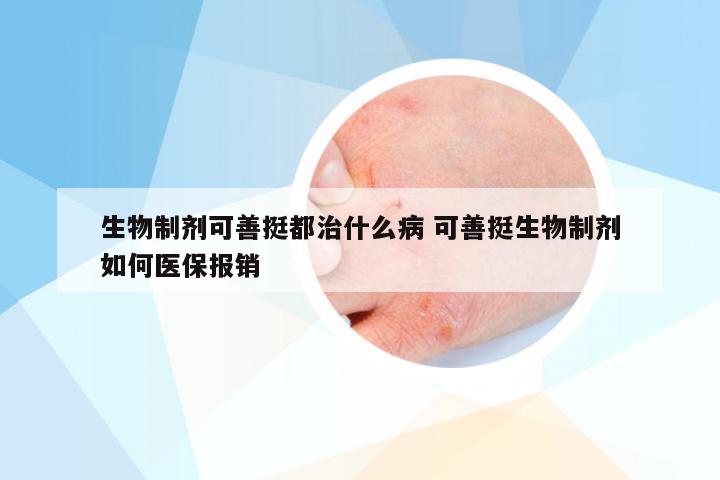 生物制剂可善挺都治什么病 可善挺生物制剂如何医保报销