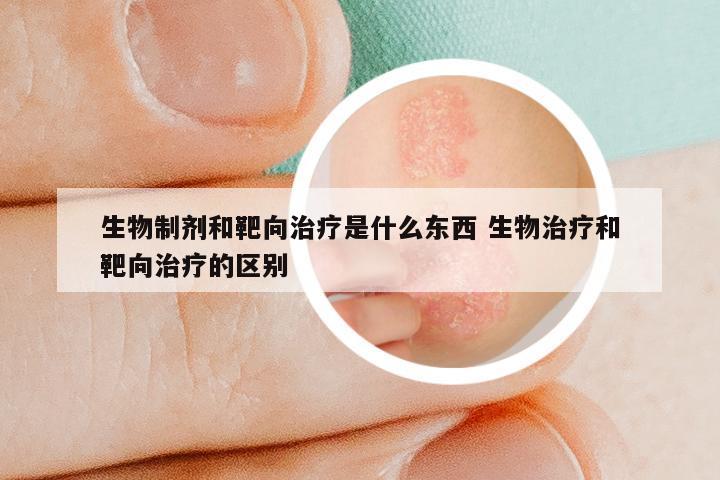 生物制剂和靶向治疗是什么东西 生物治疗和靶向治疗的区别