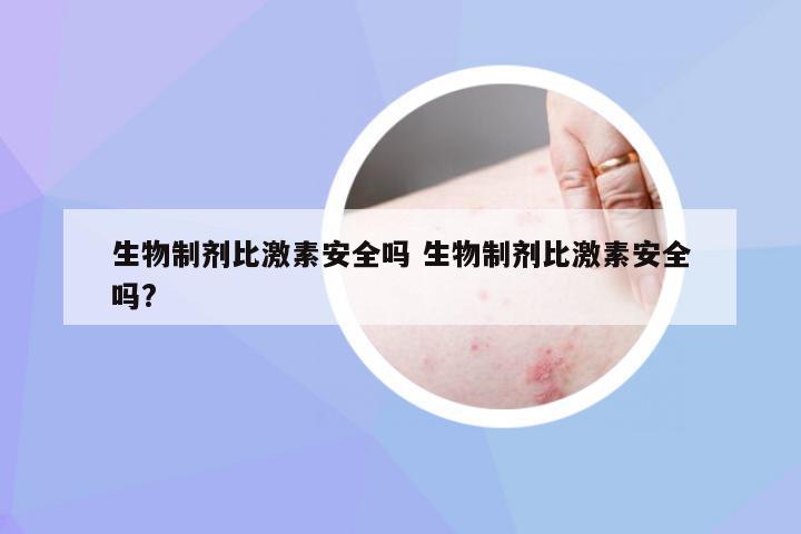 生物制剂比激素安全吗 生物制剂比激素安全吗?