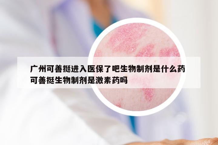 广州可善挺进入医保了吧生物制剂是什么药 可善挺生物制剂是激素药吗