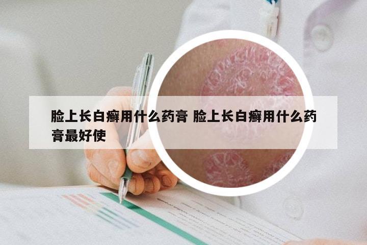 脸上长白癣用什么药膏 脸上长白癣用什么药膏最好使