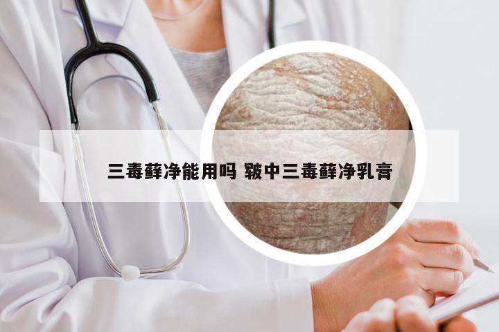 三毒藓净能用吗 皲中三毒藓净乳膏