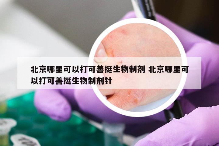 北京哪里可以打可善挺生物制剂 北京哪里可以打可善挺生物制剂针