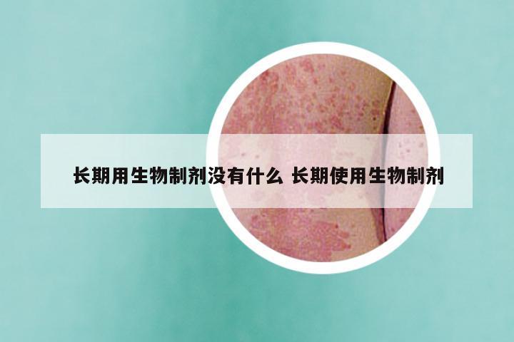 长期用生物制剂没有什么 长期使用生物制剂