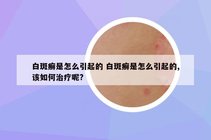 白斑癣是怎么引起的 白斑癣是怎么引起的,该如何治疗呢?