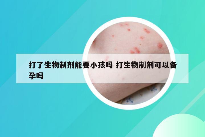 打了生物制剂能要小孩吗 打生物制剂可以备孕吗