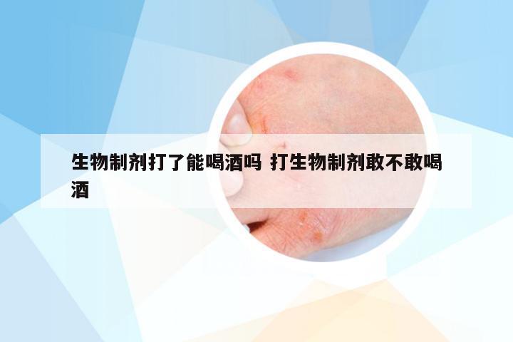 生物制剂打了能喝酒吗 打生物制剂敢不敢喝酒