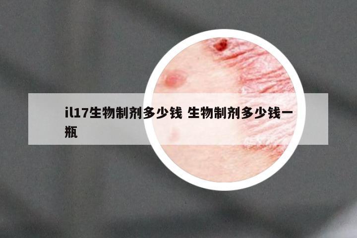 il17生物制剂多少钱 生物制剂多少钱一瓶