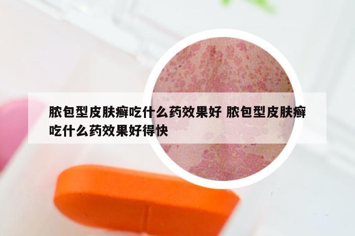 脓包型皮肤癣吃什么药效果好 脓包型皮肤癣吃什么药效果好得快